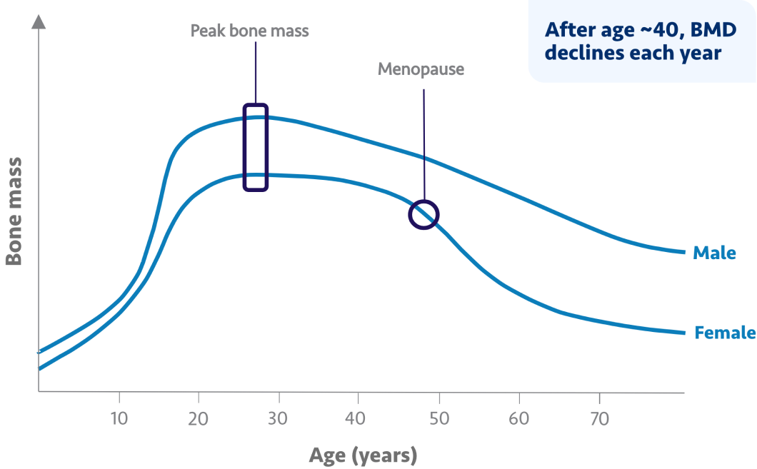 Chart showing decline in BMD with age